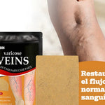 PARCHES PARA VÁRICES
